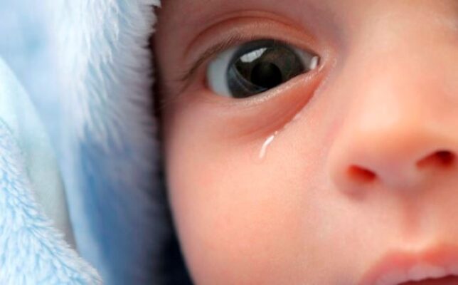 علت آبریزش چشم نوزاد و روش های درمان آن