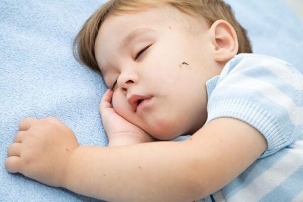 درمان نیش حشرات در نوزادان و کودکان